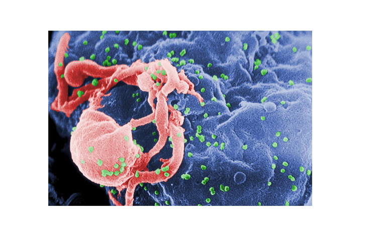 Guinea short of HIV anti-retrovirals: govt