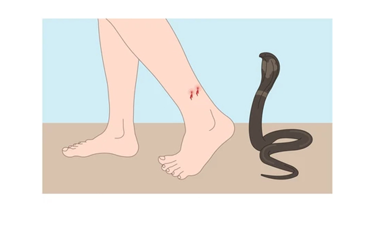 Madrasah student dies from snakebite in Magura