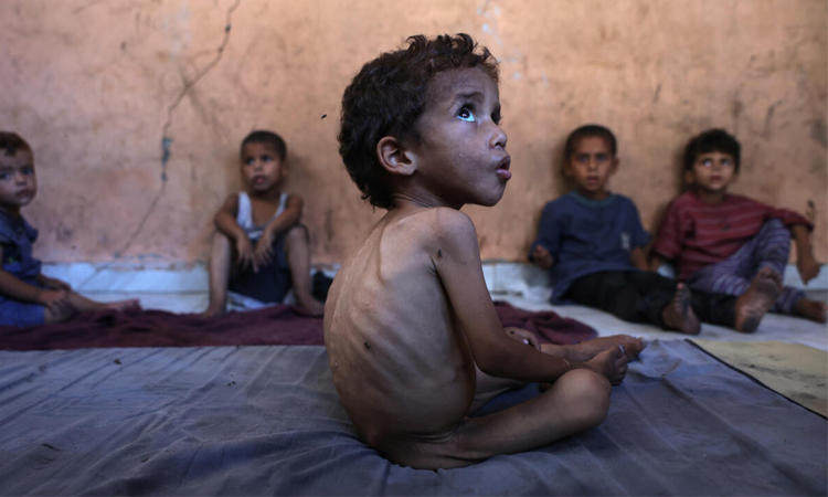 'Famine', 'starvation': the challenges in defining Gaza's plight