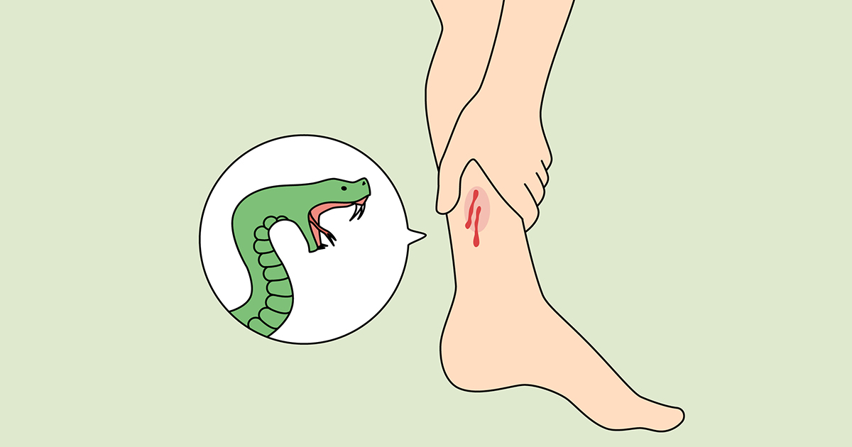 Minor girl dies from snakebite in Jhenaidah 