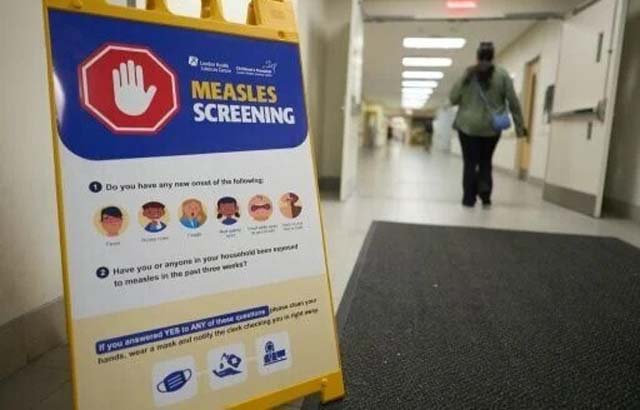 Canada reports first death linked to measles epidemic