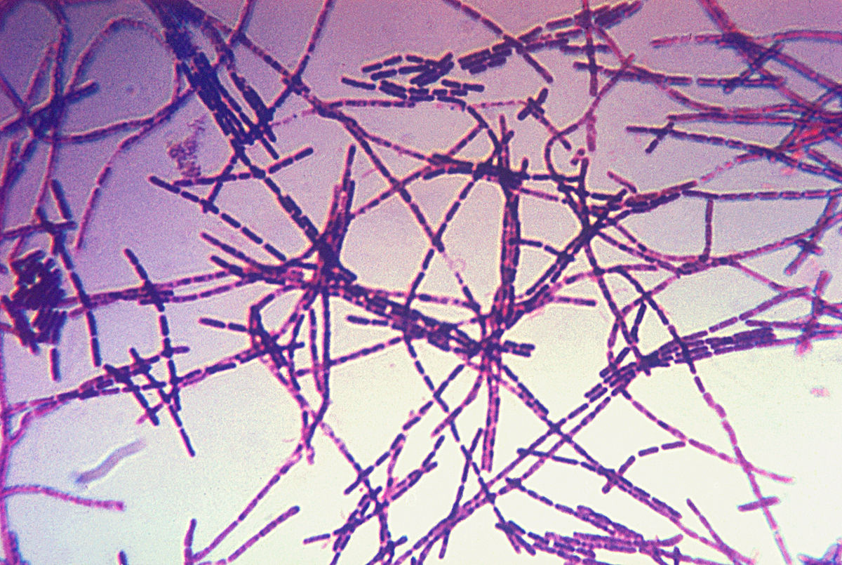 Livestock dept launches urgent, coordinated activities to roll back anthrax