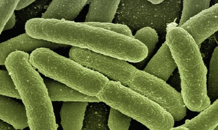 Spread of drug-resistant superbugs surging, WHO warns