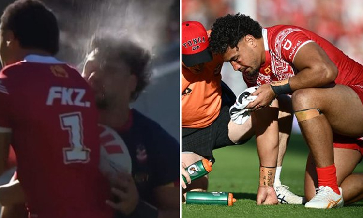 Tonga rugby league star has surgery after 'seizure' against NZ