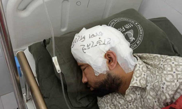 CU student Mamun's skull successfully transplanted after two months