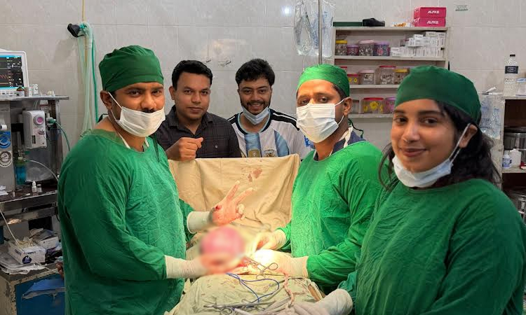3kg tumor successfully removed from woman in Chandpur