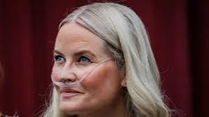Norway crown princess has successful lung transplant