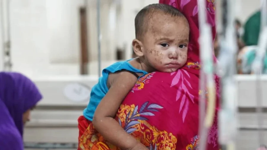 3 more die from suspected measles
